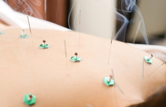 「症状改善」鍼灸コース